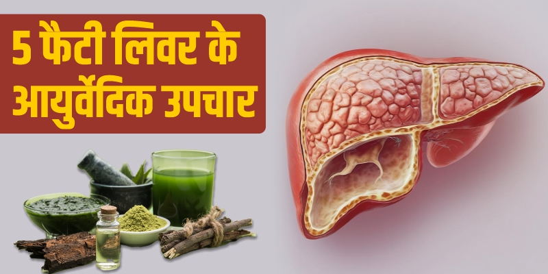 फैटी-लिवर-के-आयुर्वेदिक-उपचार